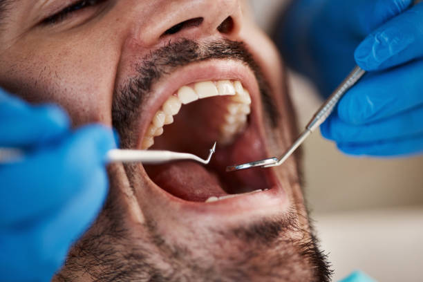 Best Emergency Treatment for Dental Infections or Abscesses in Lincoln, AR