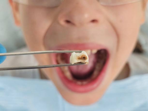 Best Same-Day Emergency Dental Services in Lincoln, AR